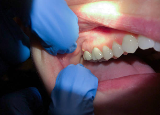 Best Emergency Denture Repair in Midland, TX